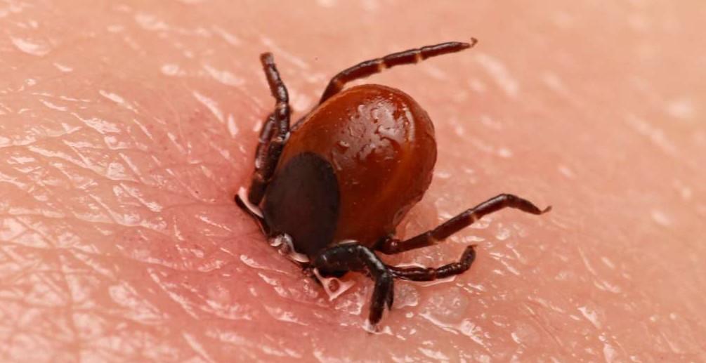 Maladie de Lyme 