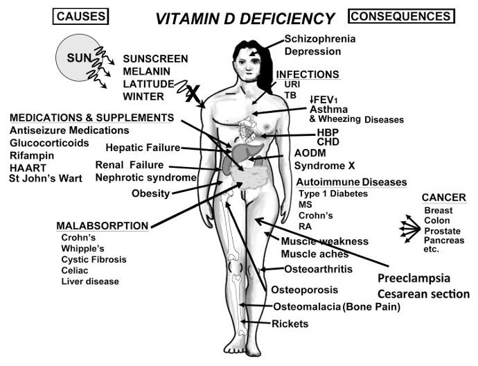 schéma vit D
